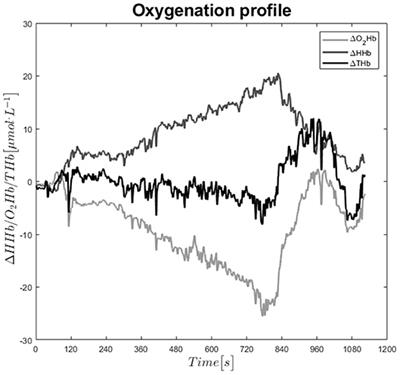 <mark class="highlighted">Oxygen Availability</mark> in Respiratory Muscles During Exercise in Children Following Fontan Operation
